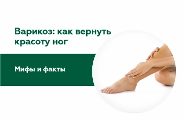 Мифы и факты о варикозе: как вернуть красоту ног