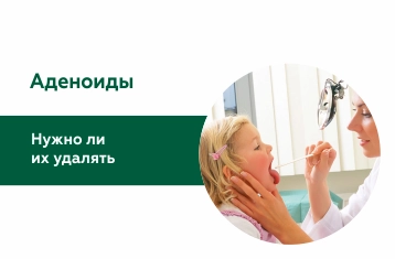 Аденоиды - нужно ли их удалять?