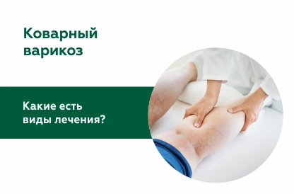 Коварный варикоз